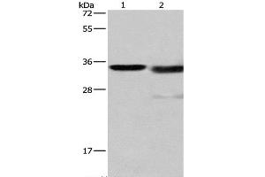 Western Blot analysis of Mouse kidney tissue and A172 cell using Cathepsin L Polyclonal Antibody at dilution of 1:900 (Cathepsin L 抗体)