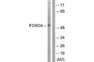 Western blot analysis of extracts from K562 cells, using FOXO4 (Ab-451) Antibody.