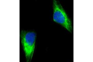 Immunofluorescent analysis of 4 % paraformaldehyde-fixed, 0. (MUT 抗体  (AA 492-526))