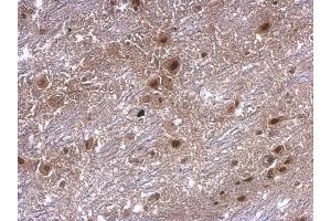 IHC-P Image axin 2 antibody [N2C2], Internal detects axin 2 protein at cytosol on mouse hind brain by immunohistochemical analysis. (AXIN2 抗体)