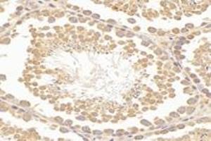 Immunohistochemistry (Paraffin-embedded Sections) (IHC (p)) image for anti-rho-Related BTB Domain Containing 3 (RHOBTB3) antibody (ABIN7075422)