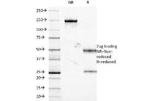 SDS-PAGE Analysis Purified TNF-alpha Mouse Monoclonal Antibody (J2D10). (TNF alpha 抗体)