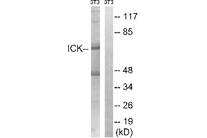 Western blot analysis of extracts from 3T3 cells, treated with PBS (10uM, 60mins), using ICK (Ab-159) antibody. (JAK3 抗体  (Tyr159))