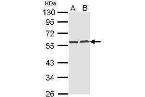 WB Image Sample (30 ug of whole cell lysate) A: Hep G2 , B: Raji 10% SDS PAGE antibody diluted at 1:1000