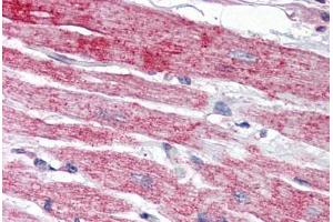 Human Heart (formalin-fixed, paraffin-embedded) stained with NPTX2 antibody ABIN343900 at 5 ug/ml followed by biotinylated goat anti-rabbit IgG secondary antibody ABIN481713, alkaline phosphatase-streptavidin and chromogen. (NPTX2 抗体  (Internal Region))
