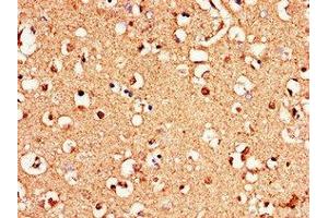 Immunohistochemistry of paraffin-embedded human brain tissue using ABIN7159432 at dilution of 1:100 (Metabotropic Glutamate Receptor 1 抗体  (AA 880-1017))