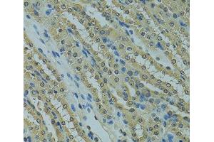 Immunohistochemistry of paraffin-embedded Mouse kidney using UBE2I Polyclonal Antibody at dilution of 1:100 (40x lens). (UBE2I 抗体)