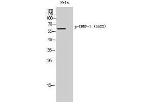 Western Blotting (WB) image for anti-Dihydropyrimidinase-Like 2 (DPYSL2) (pSer522) antibody (ABIN3173158) (DPYSL2 抗体  (pSer522))