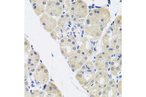 Immunohistochemistry of paraffin-embedded human stomach using ALAD antibody (ABIN5974581) at dilution of 1/100 (40x lens). (ALAD 抗体)