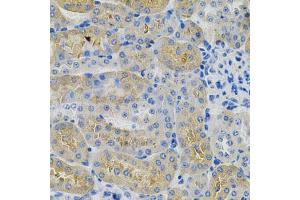 Immunohistochemistry of paraffin-embedded mouse kidney using ANGPTL3 Antibody (ABIN1870975) at dilution of 1:100 (40x lens).