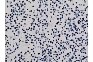 ICC staining of human HepG2 cells with recombinant H3K79me2 antibody. (Recombinant Histone 3 抗体  (2meLys79))