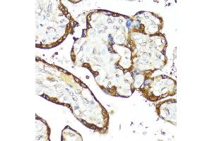 Immunohistochemistry of paraffin-embedded Human placenta using IFN antibody (ABIN3015562, ABIN3015563, ABIN3015564 and ABIN6218872) at dilution of 1:100 (40x lens).
