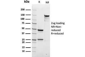 SDS-PAGE Analysis Purified SPTBN2 Recombinant Mouse Monoclonal Antibody (rSPTBN2/1778). (Recombinant Spectrin, Beta, Non-erythrocytic 2 (SPTBN2) (AA 356-475) 抗体)