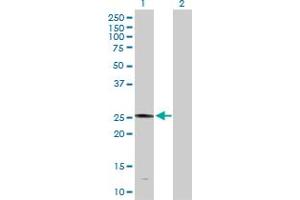 Western Blot analysis of PLA2G4D expression in transfected 293T cell line by PLA2G4D MaxPab polyclonal antibody. (PLA2G4D 抗体  (AA 1-216))