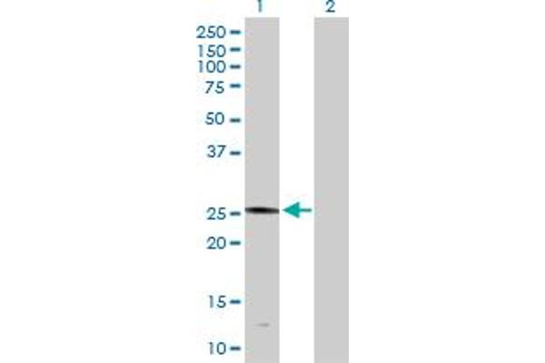 PLA2G4D antibody  (AA 1-216)