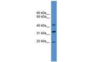 Image no. 1 for anti-ADP-Ribosylation Factor Interacting Protein 1 (ARFIP1) (C-Term) antibody (ABIN6746382) (ARFIP1 抗体  (C-Term))