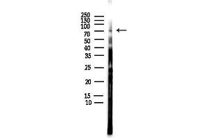 anti-Mitogen-Activated Protein Kinase Kinase Kinase 3 (MAP3K3) antibody
