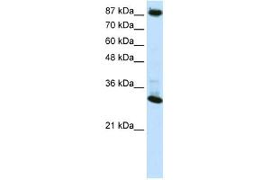 WB Suggested Anti-CTCF Antibody Titration:  0. (CTCF 抗体  (N-Term))