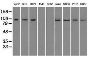 Image no. 2 for anti-Neurotrophic tyrosine Kinase, Receptor, Type 3 (NTRK3) antibody (ABIN1499843)