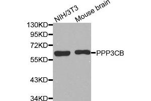 Western Blotting (WB) image for anti-Protein Phosphatase 3, Catalytic Subunit, beta Isozyme (PPP3CB) antibody (ABIN1874234) (PPP3CB 抗体)