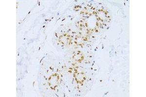 Immunohistochemistry of paraffin-embedded Human breast using ZEB2 Polyclonal Antibody at dilution of 1:100 (40x lens). (ZEB2 抗体)