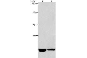Western Blot analysis of Hela and A431 cell using CSNK1E Polyclonal Antibody at dilution of 1:1550 (CK1 epsilon 抗体)