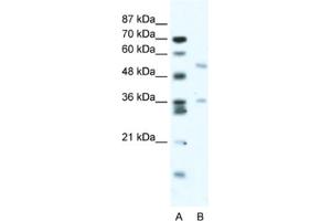 Western Blotting (WB) image for anti-BTB (POZ) Domain Containing 3 (BTBD3) antibody (ABIN2461041) (BTBD3 抗体)