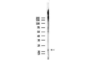 Western blot analysis of lysates from Mouse lung, using Rab10 Antibody at 1/1000 dilution.