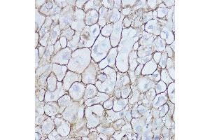 Immunohistochemistry (IHC) image for anti-CD44 (CD44) (AA 148-247) antibody (ABIN6138193)