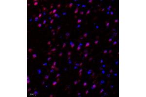 Immunofluorescence of paraffin embedded mouse hippocampus using Suv39h2 (ABIN7075771) at dilution of 1:2000 (400x lens) (SUV39H2 抗体)