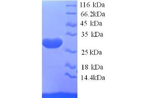 SDS-PAGE (SDS) image for Potassium Voltage-Gated Channel, Shal-Related Subfamily, Member 2 (KCND2) (AA 406-630), (Cytoplasmic Domain), (Cytosolic) protein (His tag) (ABIN5713576)