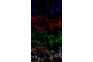 Immunocytochemistry/Immunofluorescence analysis using Mouse Anti-Acrolein Monoclonal Antibody, Clone 10A10 . (Acrolein 抗体  (Atto 594))