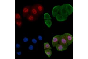 ABIN6256258 and ABIN6267588 staining Hela cells(30 min of UV treatment) by IF/ICC. (RUNX1 抗体  (pSer304))