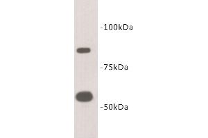 Western Blotting (WB) image for anti-Transmembrane Protein 2 (TMEM2) antibody (ABIN1854991) (TMEM2 抗体)