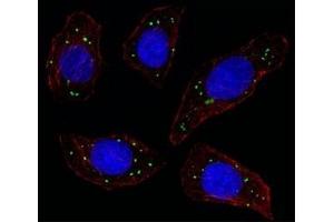Fluorescent image of U251 cell stained with MERTK antibody at 1:25. (MERTK 抗体)