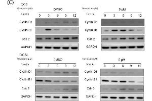 Western Blotting (WB) image for anti-Cyclin B1 (CCNB1) antibody (ABIN2854892)