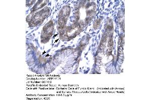 Rabbit Anti-EAP30 Antibody  Paraffin Embedded Tissue: Human Stomach Cellular Data: Epithelial cells of Fundic Gland and Surface Mucous Cells Antibody Concentration: 4. (SNF8 抗体  (N-Term))