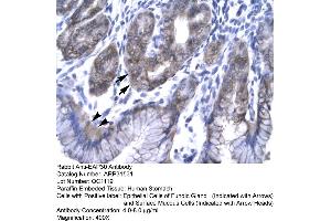 Rabbit Anti-EAP30 Antibody  Paraffin Embedded Tissue: Human Stomach Cellular Data: Epithelial cells of Fundic Gland and Surface Mucous Cells Antibody Concentration: 4. (SNF8 抗体  (N-Term))