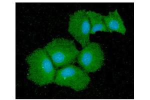 ICC/IF analysis of QPRT in Hep3B cells line, stained with DAPI (Blue) for nucleus staining and monoclonal anti-human QPRT antibody (1:100) with goat anti-mouse IgG-Alexa fluor 488 conjugate (Green). (QPRT 抗体  (AA 1-297))