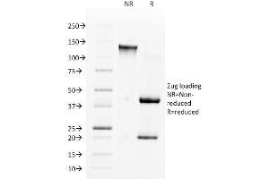 SDS-PAGE Analysis Purified ACE / CD143 Mouse Monoclonal Antibody (9B9). (Angiotensin I Converting Enzyme 1 抗体)