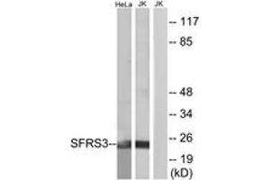 Western blot analysis of extracts from HeLa/Jurkat cells, using SFRS3 Antibody. (SRSF3 抗体  (AA 111-160))