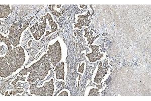 IHC analysis of HDAC5 using anti-HDAC5 antibody (ABIN7599922). (HDAC5 抗体  (AA 13-1107))