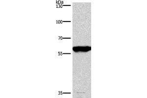 Western blot analysis of Mouse brain tissue, using PPP3CA Polyclonal Antibody at dilution of 1:900 (PPP3CA 抗体)