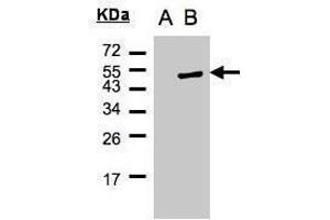 WB Image Western Blot analysis of PSCD1 expression in transfected 293T cell line by PSCD1 polyclonal antibody. (Cytohesin 1 抗体)