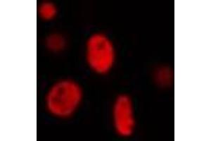 ABIN6274282 staining Hela cells by IF/ICC. (ZNF134 抗体)