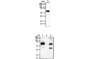 The cell lysates (40ug) were resolved by SDS-PAGE, transferred to PVDF membrane and probed with anti-human AKT1/3 antibody (1:1000). (AKT1/3 抗体)