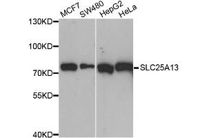 Western blot analysis of extracts of various cell lines, using SLC25A13 antibody. (slc25a13 抗体)