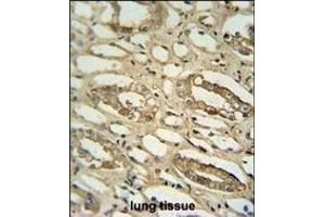 GGTLC2 antibody (Center) (ABIN654174 and ABIN2844032) immunohistochemistry analysis in formalin fixed and paraffin embedded human lung tissue followed by peroxidase conjugation of the secondary antibody and DAB staining. (GGTLC2 抗体  (AA 127-154))