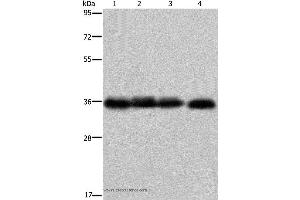 Western blot analysis of K562 cell and  human kidney cancer tissue, 293T and HepG2 cell, using F11R Polyclonal Antibody at dilution of 1:600 (F11R 抗体)