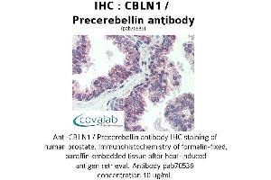 Image no. 1 for anti-Cerebellin 1 Precursor (CBLN1) antibody (ABIN1732717) (CBLN1 抗体)